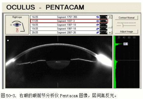 ZY016_268_4.gif